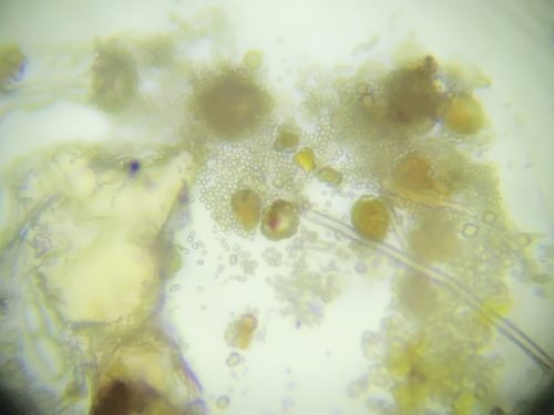 Schimmelpilz unter dem Mikroskop - Tesafilmabklatsch